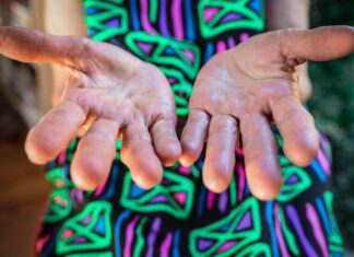 Head thick with things person opening palms close up photo