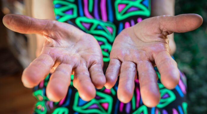 Head thick with things person opening palms close up photo